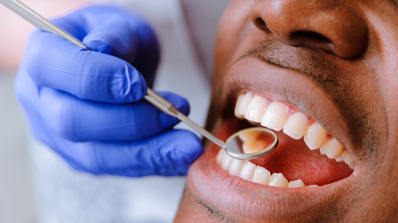 11-popular-foods-and-drinks-that-stain-your-teeth-15.jpg