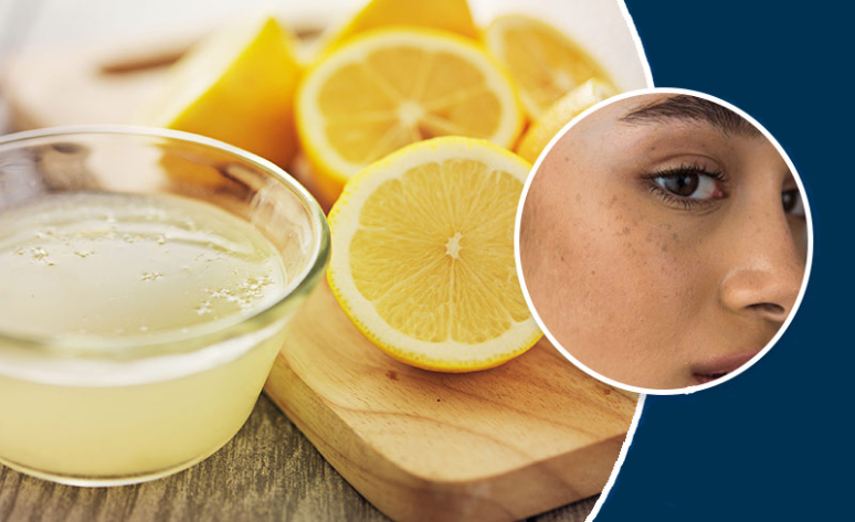 13-amazing-things-you-can-do-with-a-lemon-1.jpg