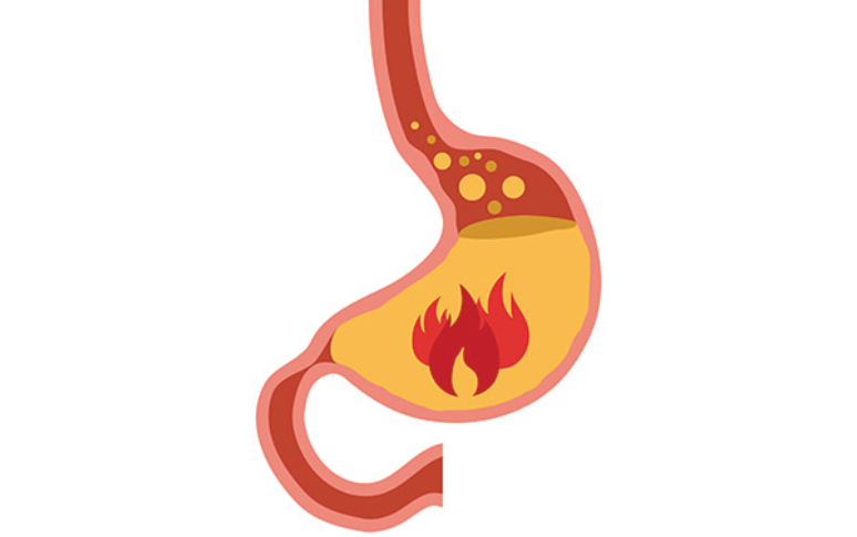 5-little-known-side-effects-of-fish-oil-6.jpg