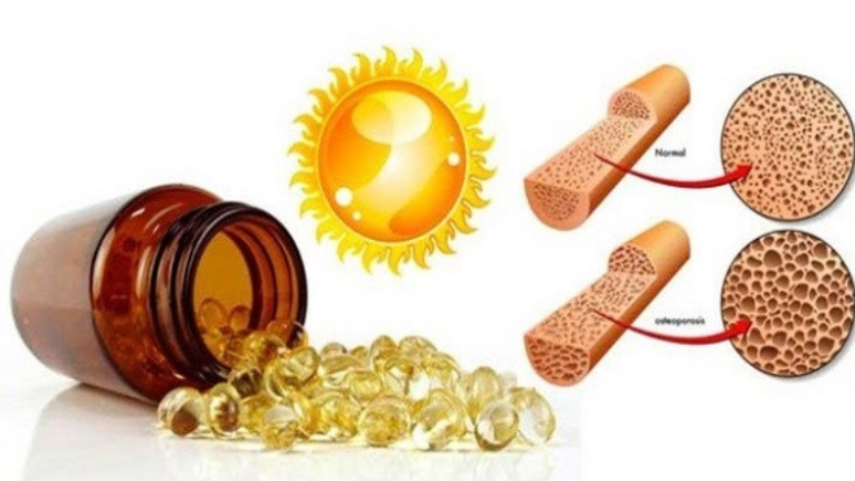 5-nutritional-tips-to-beat-chronic-lower-back-pain-5.jpg