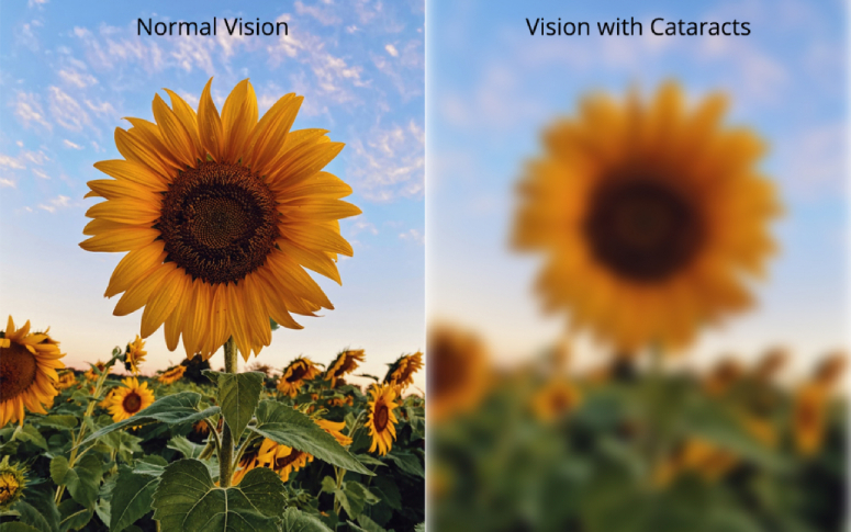 7-signs-you-may-have-cataracts-1.jpg