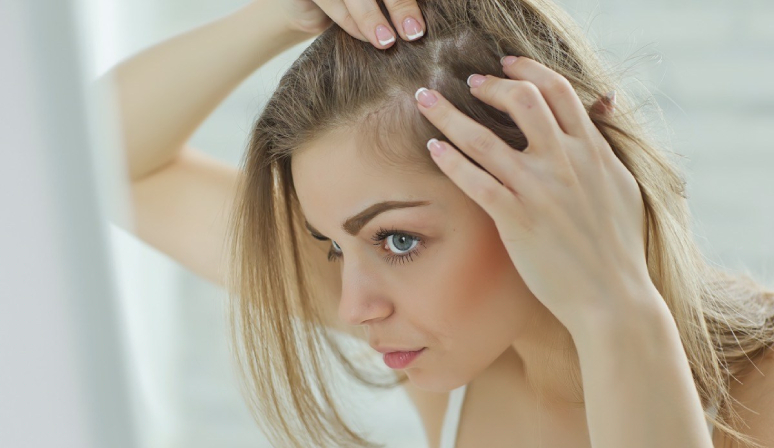 8-best-foods-to-stop-hair-loss-naturally-1.jpg