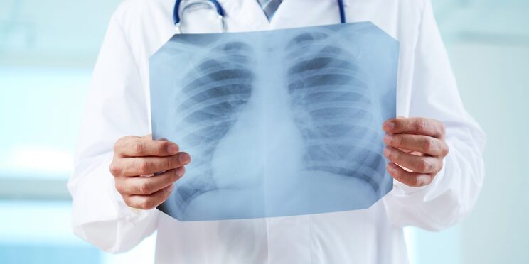 8-signs-that-you-may-be-at-risk-of-skin-cancer-7.jpg