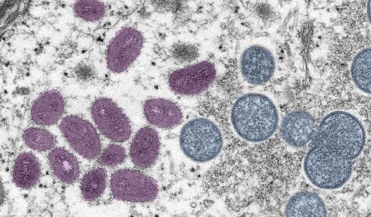 8-things-you-need-to-know-about-monkeypox-1.jpg