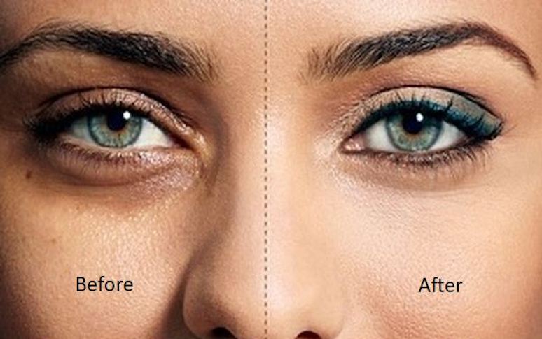 9-tips-for-getting-rid-of-dark-circles-6.jpg