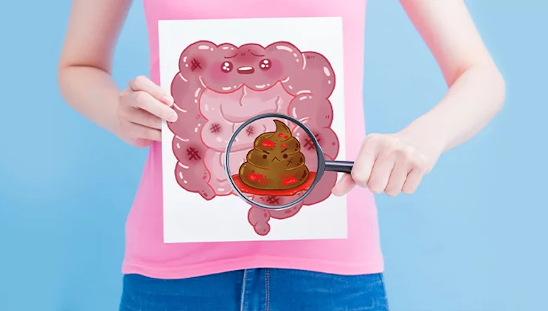 dont-overlook-7-symptoms-that-signal-colon-cancer-3.jpg
