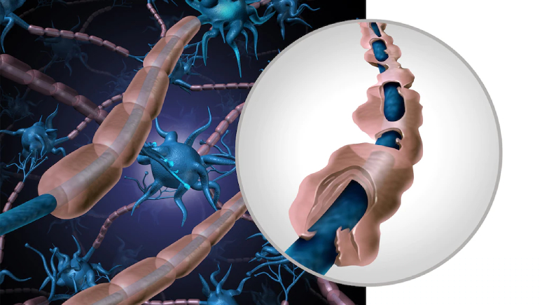 johnson-johnsons-covid-19-vaccine-is-linked-to-a-rare-neurological-disorder-2.jpg