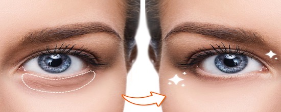 9-tips-for-getting-rid-of-dark-circles